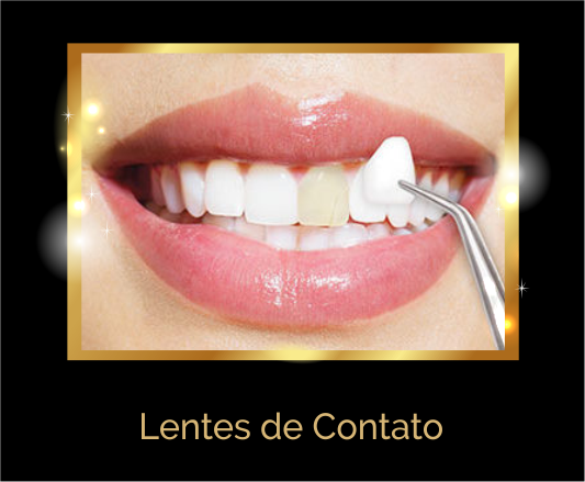 Lentes de contato Odontológicas