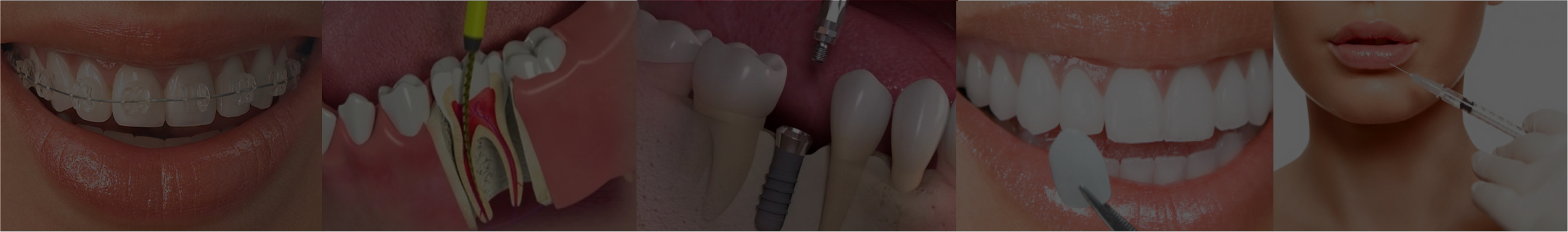 Tratamentos Odontológicos